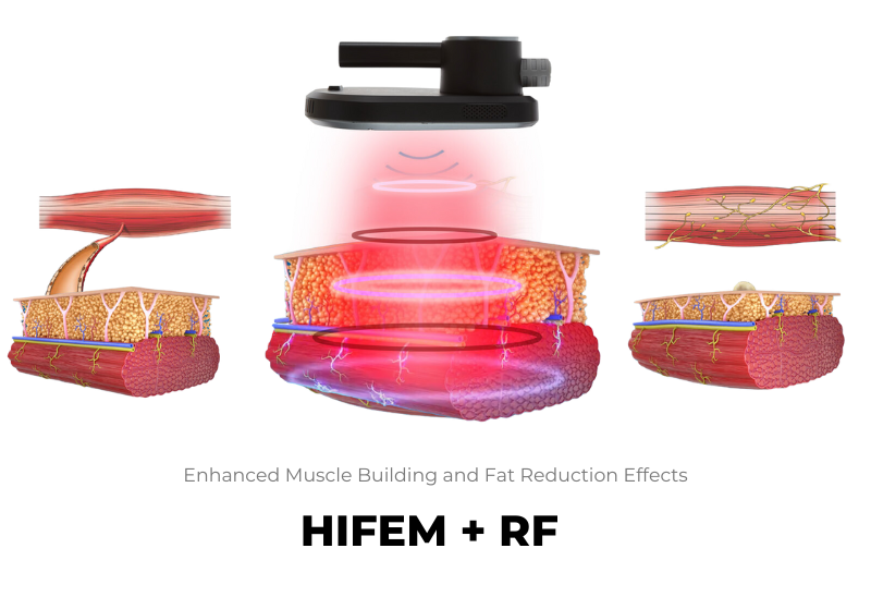 Muscle Building and Fat Reduction effects of NuTone