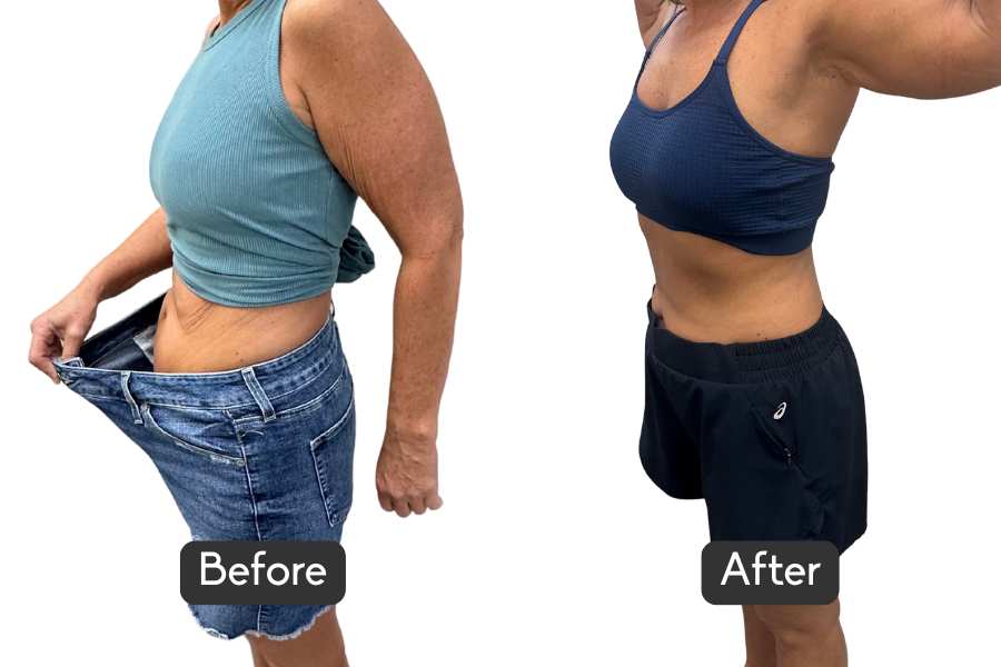 nuFORM Before & After