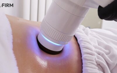 The Physics Behind RF Body Contouring: Why Rotation Angle and Vacuum Matter More Than You Think