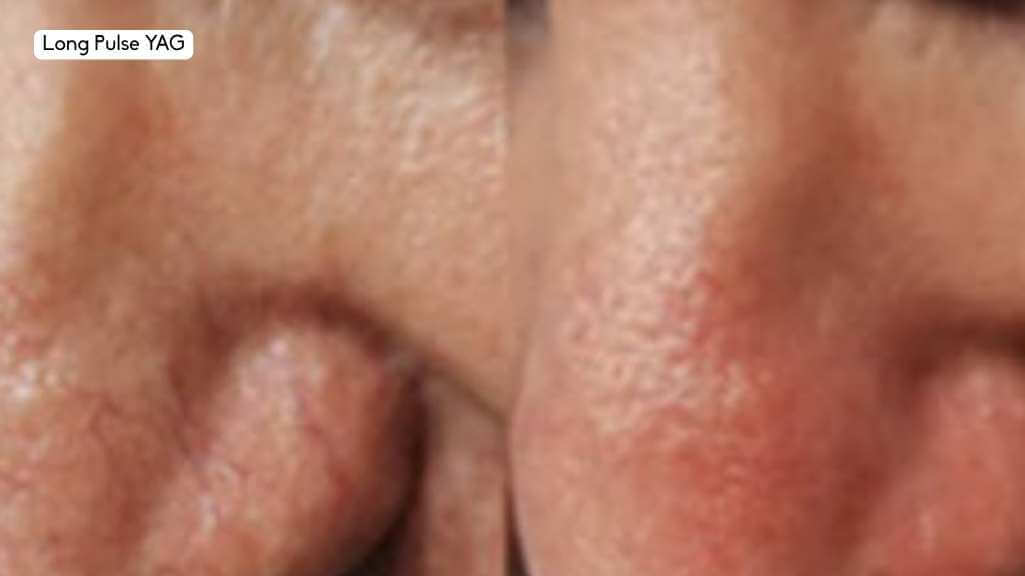 nuCORE Before & After