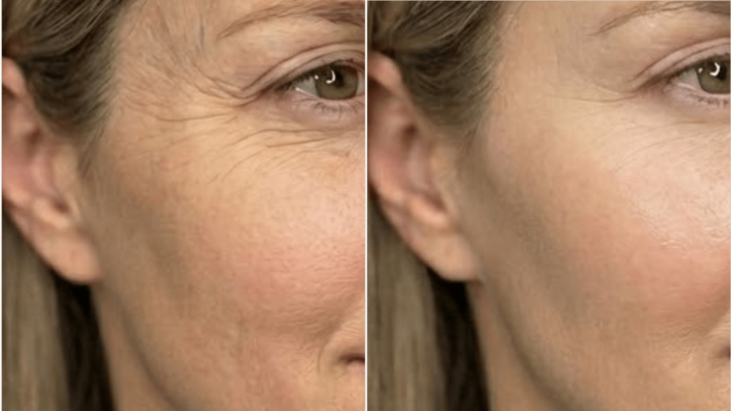 nuCORE Before & After